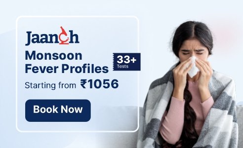 JAANCH MONSOON FEVER SCREEN WITH URINE ANALYSIS