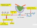 ANTI GLOMERULAR BASEMENT MEMBRANE PROTEIN - IgG