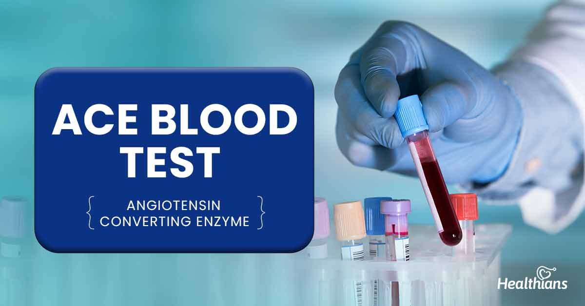 ANGIOTENSIN CONVERTING ENZYME