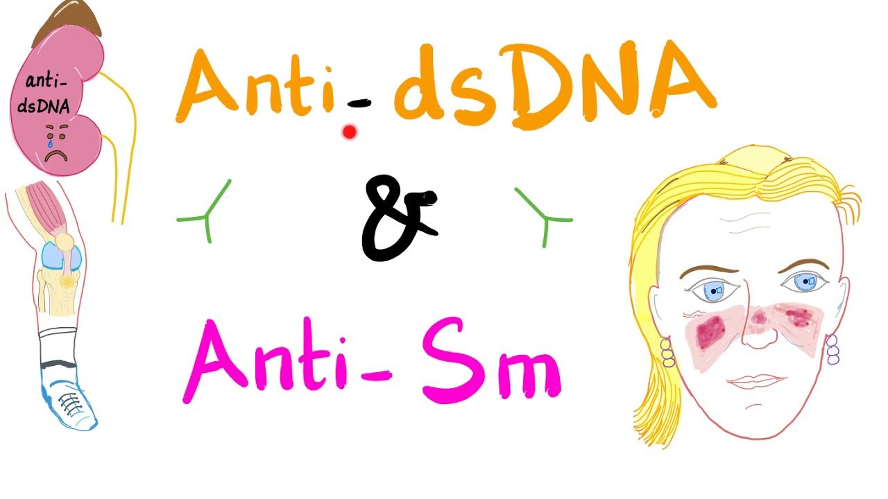 ANTI - DSDNA