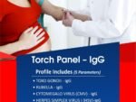 TORCH PANEL - IGG
