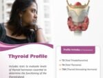 T3-T4-TSH(  THYROID PROFILE TOTAL)