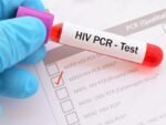 HIV 1 & 2 ANTIBODIES SCREENING TEST