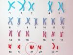 CHROMOSOME ANALYSIS (KARYOTYPE), BLOOD