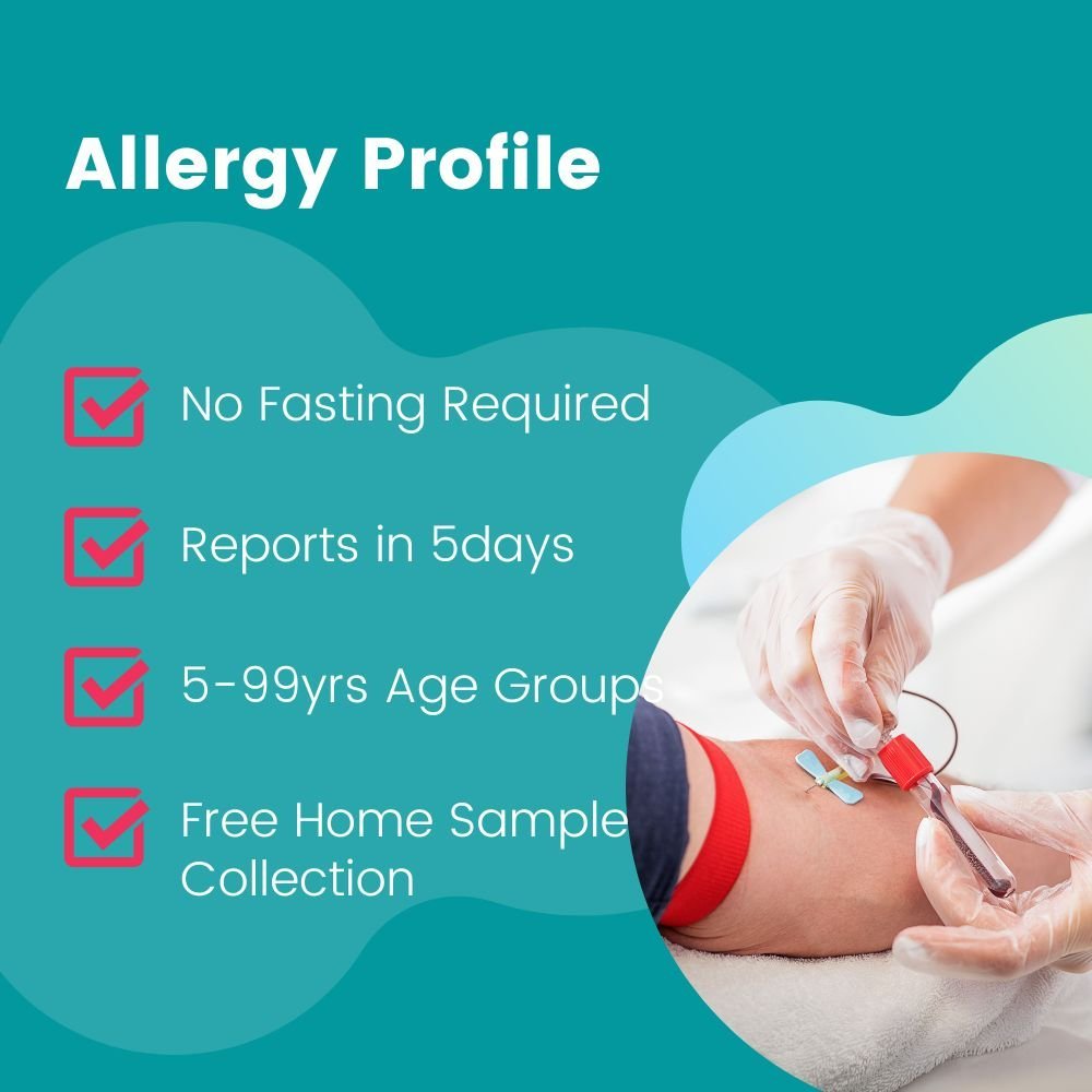 ALLERGY TOMATO ( BY PHADIA)