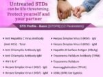 STD PROFILE BASIC