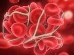VENOUS THROMBOSIS RISK ANALYSIS PANEL